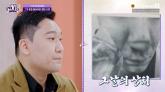 '자산 27억' 환경미화원 '무장 강도 만나 코·팔 잘려' 충격 고백